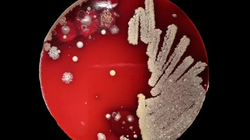 A petri dish with a red agar medium shows various colonies of bacteria growing, with dense streaks on the right and scattered colonies on the left.