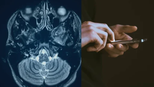 A split image showing a brain scan on the left and hands using a smartphone on the right.